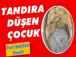 Kars'ta Çocuk Annesinin Ekmek Pişirdiği Tandıra Düştü